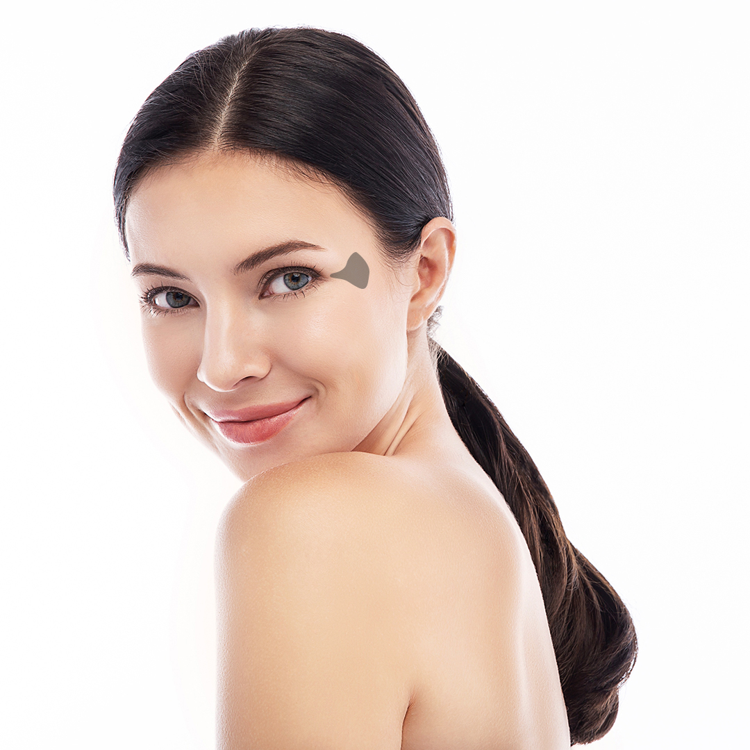 Hyalurons&auml;ure Behandlung