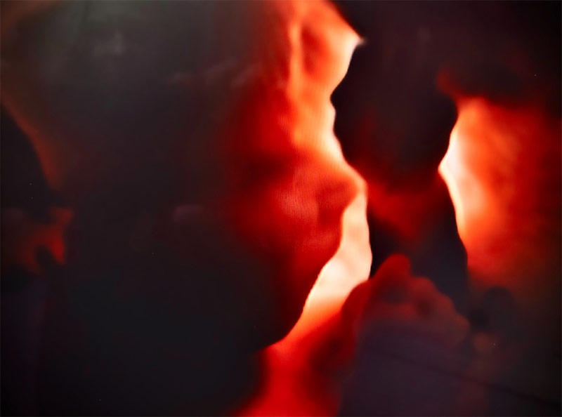 3D / 4D Ultraschall Frankfurt