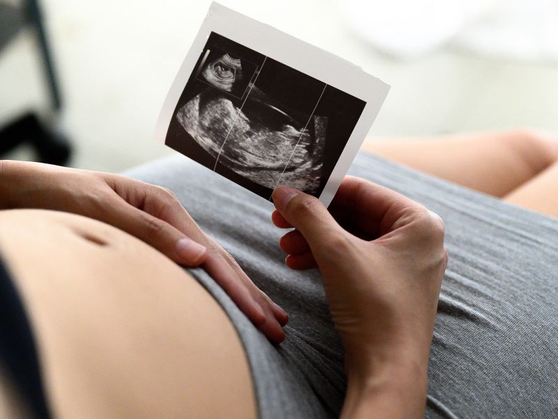 Schwangerschaftsvorsorge